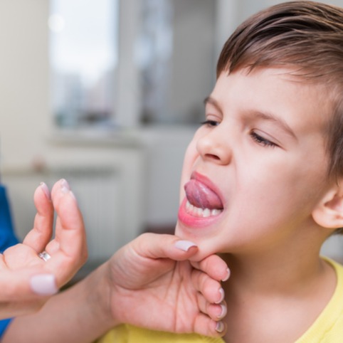 Anchiloglossia o frenulo linguale corto