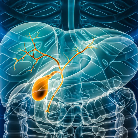 Colangiocarcinoma (tumore delle vie biliari)