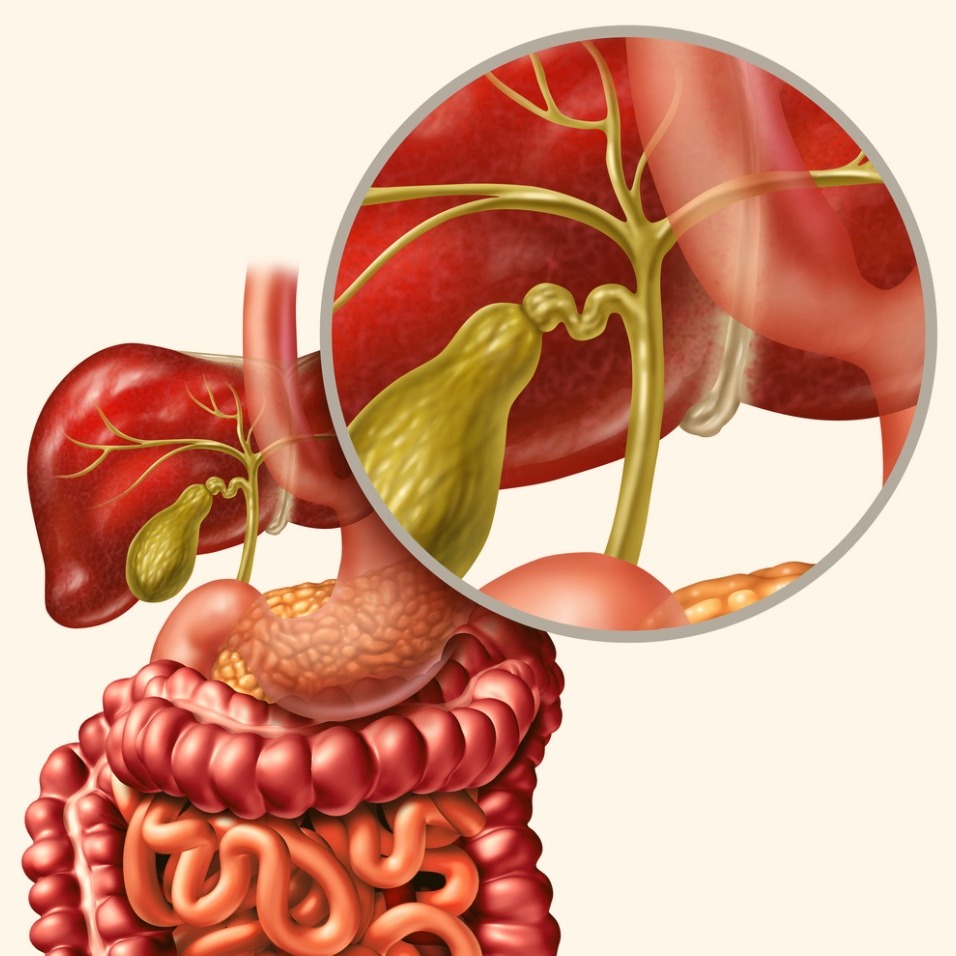 Colangiocarcinoma (tumore delle vie biliari)