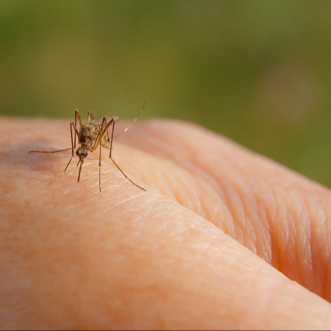 Infezione da virus West Nile