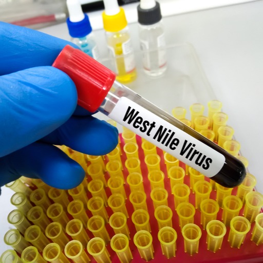 Infezione da virus West Nile